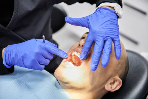 Best Emergency Dentist for Lost Fillings or Crowns in Evart, MI