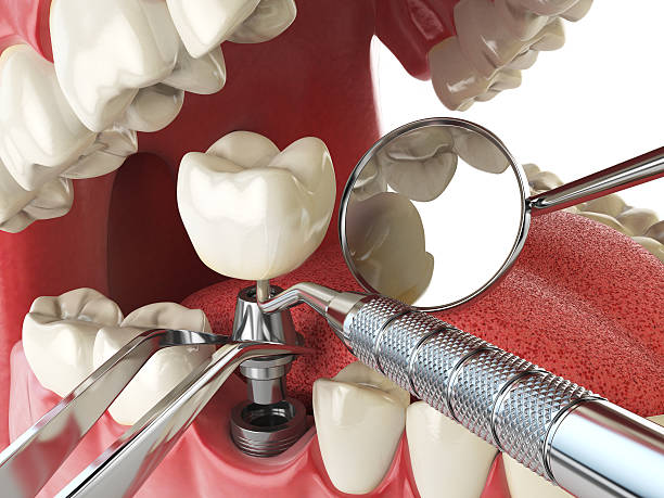 Best Weekend Emergency Dentist in Evart, MI
